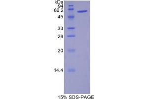 SDS-PAGE analysis of Rat Noggin Protein. (NOG Protein)