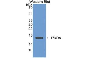 Detection of Recombinant IL2, Human using Monoclonal Antibody to Interleukin 2 (IL2) (IL-2 Antikörper  (AA 21-153))