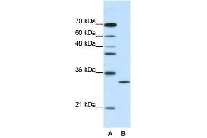 CLIC1 antibody used at 2. (CLIC1 Antikörper  (C-Term))