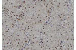 ABIN6269156 at 1/100 staining Human liver tissue by IHC-P.