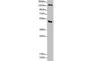 Western blot All lanes: MTUS1 antibody at 3. (MTUS1 Antikörper  (AA 1041-1270))