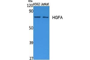 Western Blotting (WB) image for anti-Hepatocyte Growth Factor Activator (HGFA) (C-Term) antibody (ABIN3178102) (HGFA Antikörper  (C-Term))
