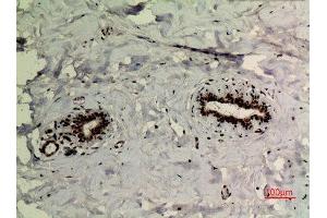 Immunohistochemistry (IHC) image for anti-Tumor Protein P73 (TP73) (acLys321) antibody (ABIN3181893)