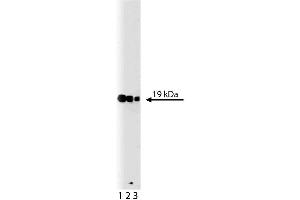 Western blot analysis of p19 [Skp1] on a A431 lysate. (SKP1 Antikörper  (AA 4-158))