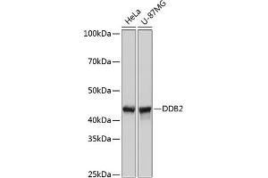 Western blot analysis of extracts of various cell lines, using DDB2 Rabbit mAb (ABIN7266674) at 1:1000 dilution. (DDB2 Antikörper)
