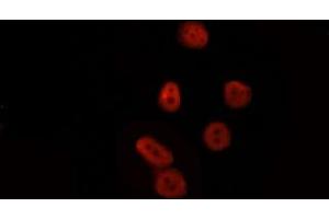 ABIN6277777 staining HepG2 by IF/ICC. (LEF1 Antikörper  (Internal Region))