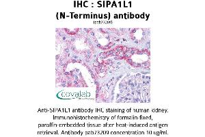 Image no. 1 for anti-Signal-Induced Proliferation-Associated 1 Like 1 (SIPA1L1) (N-Term) antibody (ABIN1739266)