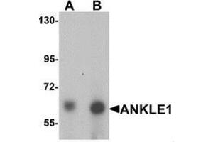Western blot analysis of ANKLE1 in 293 cell lysate with ANKLE1 antibody at (A) 1 and (B) 2 ug/mL. (ANKLE1 Antikörper  (C-Term))