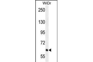 PIK3R5 Antibody (C-term) (ABIN655491 and ABIN2845011) western blot analysis in WiDr cell line lysates (35 μg/lane).