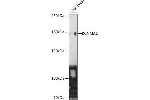 Western Blotting (WB) image for anti-Potassium Large Conductance Calcium-Activated Channel, Subfamily M, alpha Member 1 (KCNMA1) (AA 850-950) antibody (ABIN7269477)