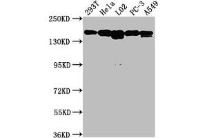 Western Blot Positive WB detected in: 293T whole cell lysate, Hela whole cell lysate, L02 whole cell lysate, PC-3 whole cell lysate, A549 whole cell lysate All lanes: MET antibody at 1:1500 Secondary Goat polyclonal to rabbit IgG at 1/50000 dilution Predicted band size: 156, 158, 86 kDa Observed band size: 156 kDa (Rekombinanter c-MET Antikörper)