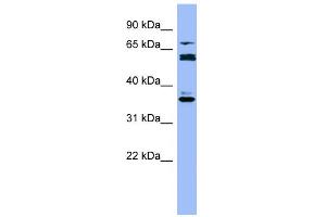 WB Suggested Anti-CYP2B6 Antibody Titration:  0.
