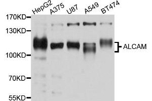 Western blot analysis of extracts of SH-SY5Y cell and HT-1080 cell line, using ALCAM antibody. (CD166 Antikörper)