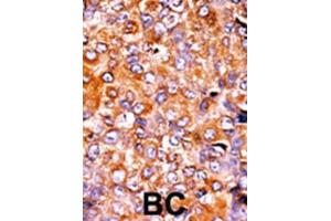 Immunohistochemistry (IHC) image for anti-Myelin Transcription Factor 1 (MYT1) (pThr495) antibody (ABIN3001766) (MYT1 Antikörper  (pThr495))