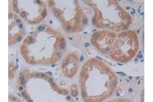 Immunohistochemistry (IHC) image for anti-Jagged 2 (JAG2) (AA 714-981) antibody (ABIN7439534)
