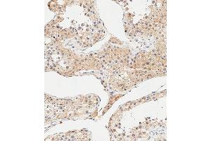 Immunohistochemical analysis of paraffin-embedded Human testis tissue using B performed on the Leica® BOND RXm. (AMHR2 Antikörper  (N-Term))