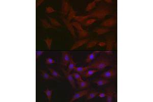Immunofluorescence analysis of NIH/3T3 cells using RIPK3 Rabbit pAb (ABIN6132598, ABIN6146964, ABIN6146967 and ABIN6221084) at dilution of 1:50 (40x lens). (RIPK3 Antikörper  (AA 1-120))