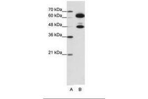 Image no. 1 for anti-Small Nuclear Ribonucleoprotein 70kDa (U1) (SNRNP70) (AA 301-350) antibody (ABIN6736194) (SNRNP70 Antikörper  (AA 301-350))