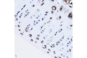Immunohistochemistry of paraffin-embedded Rat leg bone using PTH1R Rabbit pAb (ABIN3022477, ABIN3022478, ABIN3022479, ABIN1513445 and ABIN6218844) at dilution of 1:100 (40x lens). (PTH1R Antikörper  (AA 464-593))