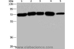 Western blot analysis of A172, Hela and 293T cell, K562 cell and human testis tissue, using AGFG1 Polyclonal Antibody at dilution of 1:533 (AGFG1 Antikörper)