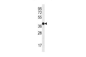 C Antibody (C-term) (ABIN656473 and ABIN2845754) western blot analysis in MDA-M cell line lysates (35 μg/lane). (NGFR Antikörper  (C-Term))