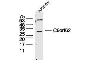Mouse kidney lysates probed with C6orf62 Polyclonal Antibody, Unconjugated  at 1:300 dilution and 4˚C overnight incubation. (C6ORF62 Antikörper  (AA 1-100))