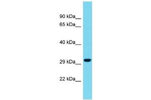 Host: Rabbit Target Name: METRNL Sample Type: Fetal Liver lysates Antibody Dilution: 1.