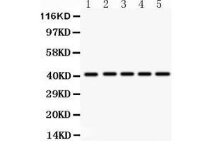 Anti- HOXA10 antibody, Western blotting All lanes: Anti HOXA10  at 0.