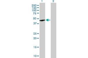 Western Blot analysis of GPR143 expression in transfected 293T cell line by GPR143 MaxPab polyclonal antibody. (GPR143 Antikörper  (AA 1-424))