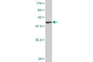 Western Blot detection against Immunogen (51. (TK1 Antikörper  (AA 1-234))