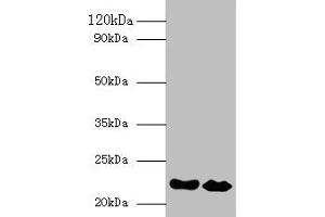 Western blot All lanes: IFNA21 antibody at 2 μg/mL Lane 1: NIH/3T3 whole cell lysate Lane 2: HepG2 whole cell lysate Secondary Goat polyclonal to rabbit IgG at 1/10000 dilution Predicted band size: 22 kDa Observed band size: 22 kDa (IFNA21 Antikörper  (AA 24-189))