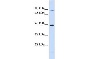 Host:  Rabbit  Target Name:  RHBDL2  Sample Type:  293T Whole Cell lysates  Antibody Dilution:  1. (RHBDL2 Antikörper  (N-Term))