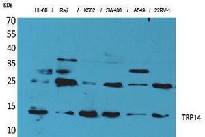 Western Blotting (WB) image for anti-Thioredoxin Domain Containing 17 (TXNDC17) (Tyr796) antibody (ABIN3178162) (TXNDC17 Antikörper  (Tyr796))