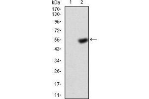 Western blot analysis using KBTBD8 mAb =against HEK293 (1) and KBTBD8 (AA: 264-464)-hIgGFc transfected HEK293 (2) cell lysate. (KBTBD8 Antikörper  (AA 264-464))