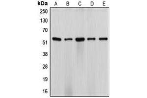 Western blot analysis of Cytochrome P450 17A1 expression in HeLa (A), NIH3T3 (B), H9C2 (C), SW13 (D), ES2 (E) whole cell lysates. (CYP17A1 Antikörper  (Center))
