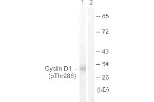 Western blot analysis of extracts from Jurkat cells, treated with EGF (200ng/ml, 30mins), using Cyclin D1 (Phospho-Thr286) antibody.