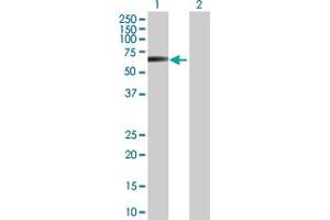 Western Blot analysis of STK38L expression in transfected 293T cell line by STK38L MaxPab polyclonal antibody.