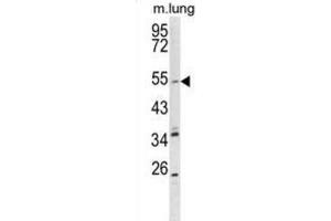 Western Blotting (WB) image for anti-Potassium Voltage-Gated Channel, KQT-Like Subfamily, Member 1 (KCNQ1) antibody (ABIN3003976)