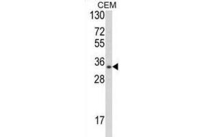 Western Blotting (WB) image for anti-Developmental Pluripotency Associated 4 (DPPA4) antibody (ABIN2997956) (DPPA4 Antikörper)