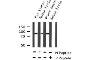 Western blot analysis of Phospho-Tau (Ser396) expression in various lysates (MAPT Antikörper  (pSer396))