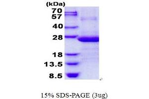 Adaptor-Related Protein Complex 3, sigma 1 Subunit (AP3S1) protein (His tag)