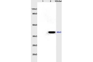 Lane 1: rat kidney lysates Lane 2: rat brain lysates probed with Anti CXCR1/IL-8RA Polyclonal Antibody, Unconjugated (ABIN730873) at 1:200 in 4 °C.