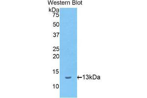 Western Blotting (WB) image for anti-Involucrin (IVL) (AA 461-551) antibody (ABIN1174489)