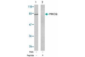 Western blot analysis of exreacts from Jurkat cells untreated or treated with PMA (1 ng/mL, 5 min) using PRKCQ polyclonal antibody . (PKC theta Antikörper)