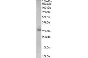 Western Blotting (WB) image for anti-Cyclin-Dependent Kinase Inhibitor 1B (p27, Kip1) (CDKN1B) (Internal Region) antibody (ABIN2465872) (CDKN1B Antikörper  (Internal Region))