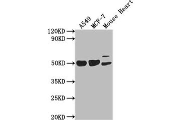 SLIT-ROBO rho GTPase Activating Protein 2B (SRGAP2B) (AA 79-150) Antikörper