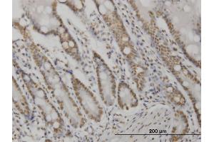 Immunoperoxidase of monoclonal antibody to AKT2 on formalin-fixed paraffin-embedded human small Intestine. (AKT2 Antikörper  (AA 100-189))