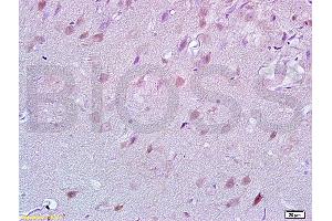 Formalin-fixed and rat brain tissue labeled with Anti-Lingo-1 Polyclonal Antibody, unconjugated  (ABIN738801)  at 1: 200 followed by incubation with conjugated secondary antibody and DAB staining (LINGO1 Antikörper  (AA 521-620))