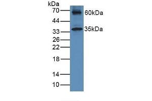 Western Blotting (WB) image for anti-Hemochromatosis Type 2 (Juvenile) (HFE2) (AA 41-386) antibody (ABIN7441934)