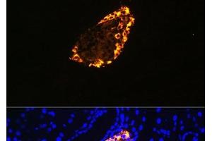 Immunofluorescence analysis of Rat pancreas using SST Polyclonal Antibody at dilution of 1:100 (40x lens). (Somatostatin Antikörper)